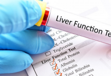 Liver Function Test